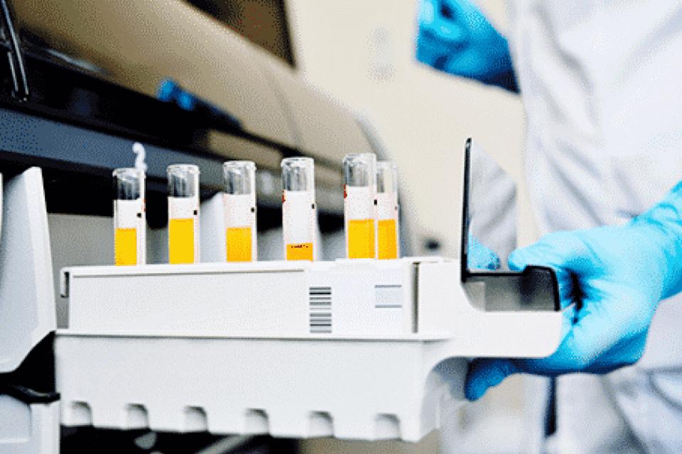 No entanto este artigo aborda os Agentes nocivos. Aposentadoria especial